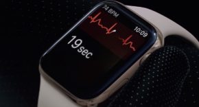 ECG del Apple Watch