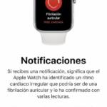 Notificaciones app Apple Watch fibrilación auricular
