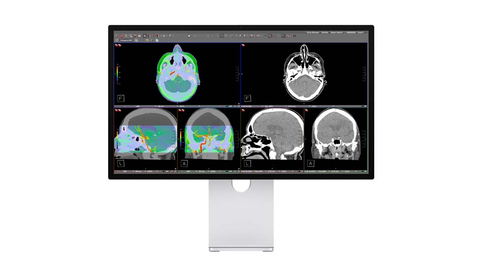 Apple Studio Display XDR